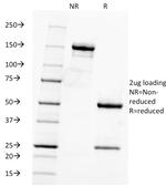 Fascin-1 (Reed-Sternberg Cell Marker) Antibody in SDS-PAGE (SDS-PAGE)