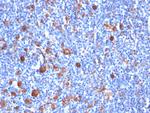 Fascin-1 (Reed-Sternberg Cell Marker) Antibody in Immunohistochemistry (Paraffin) (IHC (P))