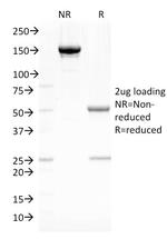 Fascin-1 (Reed-Sternberg Cell Marker) Antibody in SDS-PAGE (SDS-PAGE)