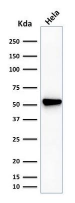 Fascin-1 (Reed-Sternberg Cell Marker) Antibody in Western Blot (WB)