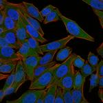 Fascin-1 (Reed-Sternberg Cell Marker) Monoclonal Antibody (FSCN1/418)