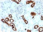 Fascin-1 (Reed-Sternberg CellMarker) Antibody in Immunohistochemistry (Paraffin) (IHC (P))