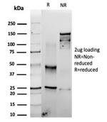 Fascin-1 (Reed-Sternberg CellMarker) Antibody in SDS-PAGE (SDS-PAGE)