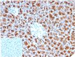 Fascin-1 (Reed-Sternberg CellMarker) Monoclonal Antibody (rFSCN1/6464)