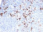 Fascin-1 (Reed-Sternberg Cell Marker) Antibody in Immunohistochemistry (Paraffin) (IHC (P))