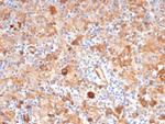 Fascin-1 (Reed-Sternberg Cell Marker) Antibody in Immunohistochemistry (Paraffin) (IHC (P))