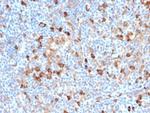 Fascin-1 (Reed-Sternberg Cell Marker) Antibody in Immunohistochemistry (Paraffin) (IHC (P))