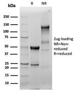 Fascin-1 (Reed-Sternberg CellMarker) Recombinant Rabbit Monoclonal Antibody (FSCN1/6465R)