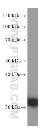 C4 gamma chain Antibody in Western Blot (WB)