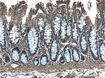 Annexin V Antibody in Immunohistochemistry (Paraffin) (IHC (P))