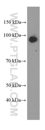 BBS2 Antibody in Western Blot (WB)