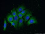 TRIM44 Antibody in Immunocytochemistry (ICC/IF)