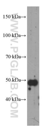 TRIM44 Antibody in Western Blot (WB)