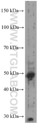 TRIM44 Antibody in Western Blot (WB)