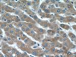 CRP Antibody in Immunohistochemistry (Paraffin) (IHC (P))