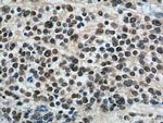PHOX2B Antibody in Immunohistochemistry (Paraffin) (IHC (P))