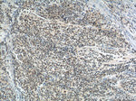 PHOX2B Antibody in Immunohistochemistry (Paraffin) (IHC (P))