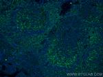 CD11a/Integrin alpha-L Antibody in Immunohistochemistry (PFA fixed) (IHC (PFA))