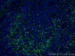 CD11a/Integrin alpha-L Antibody in Immunohistochemistry (PFA fixed) (IHC (PFA))