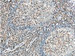 CD11a/Integrin alpha-L Antibody in Immunohistochemistry (Paraffin) (IHC (P))