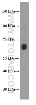 AIRE Antibody in Western Blot (WB)