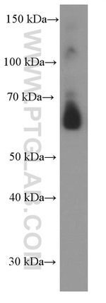 AIRE Antibody in Western Blot (WB)