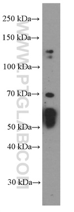 AIRE Antibody in Western Blot (WB)