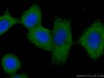 FRS2 Antibody in Immunocytochemistry (ICC/IF)