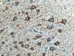 KGA Antibody in Immunohistochemistry (Paraffin) (IHC (P))