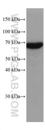 KGA Antibody in Western Blot (WB)