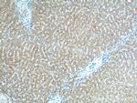 CLTB Antibody in Immunohistochemistry (Paraffin) (IHC (P))