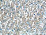 CLTB Antibody in Immunohistochemistry (Paraffin) (IHC (P))