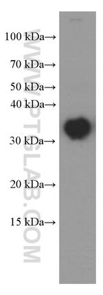 CLTB Antibody in Western Blot (WB)