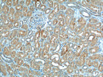 CLTB Antibody in Immunohistochemistry (Paraffin) (IHC (P))