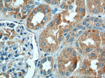 CLTB Antibody in Immunohistochemistry (Paraffin) (IHC (P))