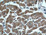 CLPP Antibody in Immunohistochemistry (Paraffin) (IHC (P))