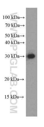 CLPP Antibody in Western Blot (WB)