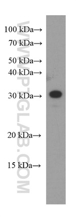 CLPP Antibody in Western Blot (WB)