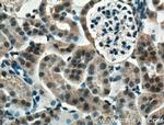 Mcp1 Antibody in Immunohistochemistry (Paraffin) (IHC (P))