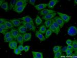 CLTCL1 Antibody in Immunocytochemistry (ICC/IF)
