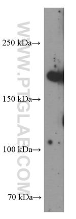CLTCL1 Antibody in Western Blot (WB)