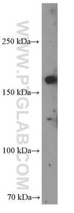 CLTCL1 Antibody in Western Blot (WB)
