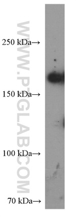 CLTCL1 Antibody in Western Blot (WB)