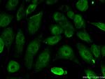 ERCC1 Antibody in Immunocytochemistry (ICC/IF)