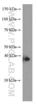 ERCC1 Antibody in Western Blot (WB)