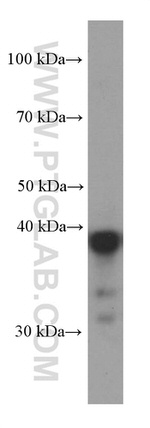 CAPG Antibody in Western Blot (WB)