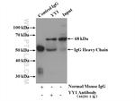 YY1 Antibody in Immunoprecipitation (IP)