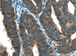IGF1R beta chain Antibody in Immunohistochemistry (Paraffin) (IHC (P))
