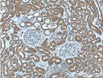 SDCCAG8 Antibody in Immunohistochemistry (Paraffin) (IHC (P))