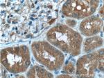 SDCCAG8 Antibody in Immunohistochemistry (Paraffin) (IHC (P))